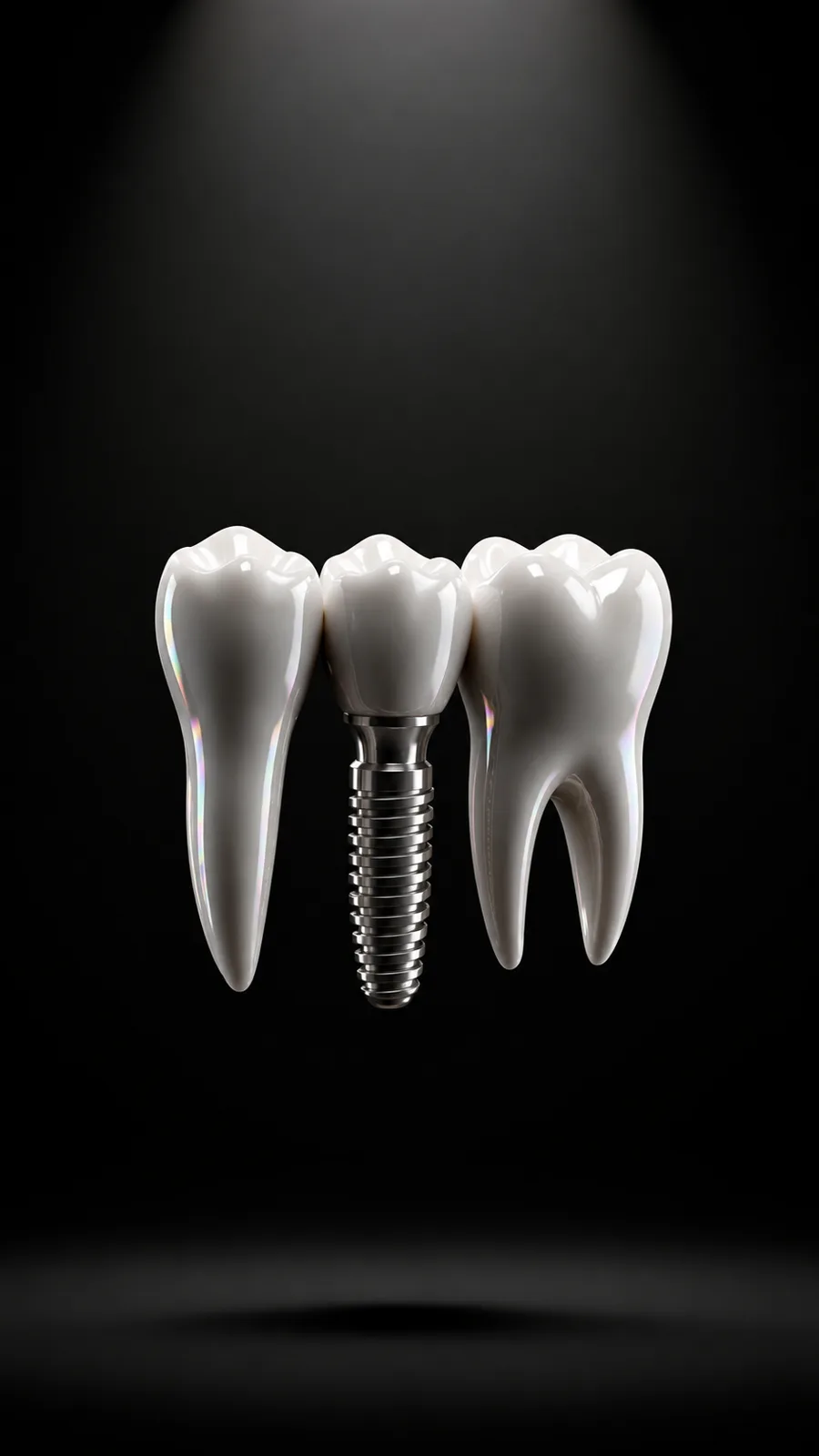 Rendu 3D — bridge sur implant dentaire